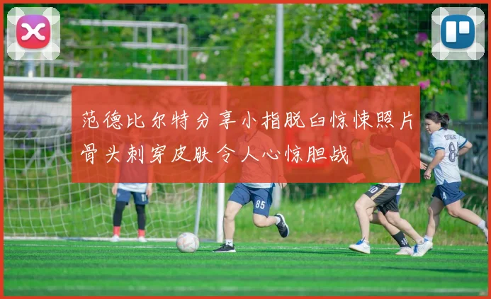 范德比尔特分享小指脱臼惊悚照片骨头刺穿皮肤令人心惊胆战